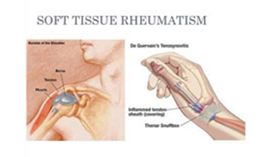 Soft-tissue-Rheumatology